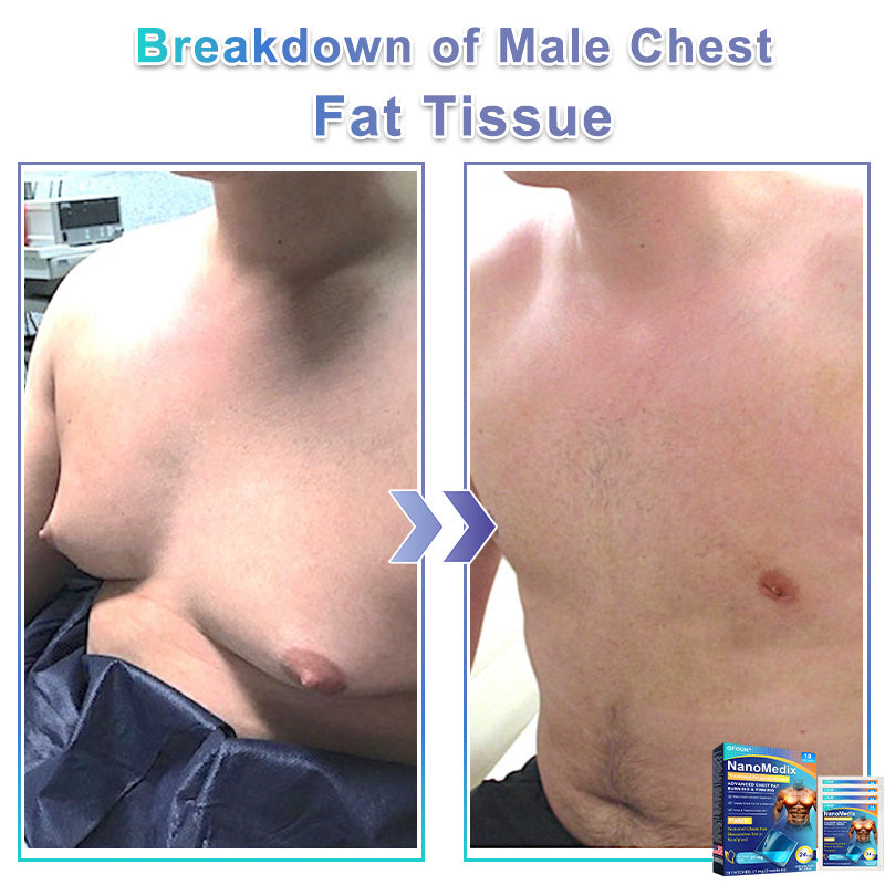 ✨GFOUK® NanoMedix Gynecomastia Chest Fatburn & Firm Patch