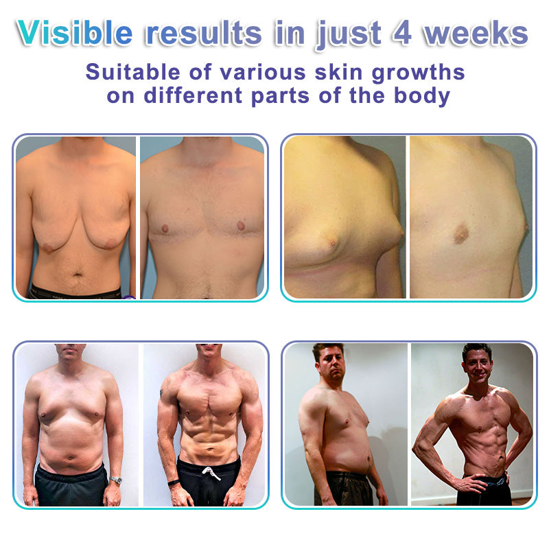 ✨GFOUK® NanoMedix Gynecomastia Chest Fatburn & Firm Patch