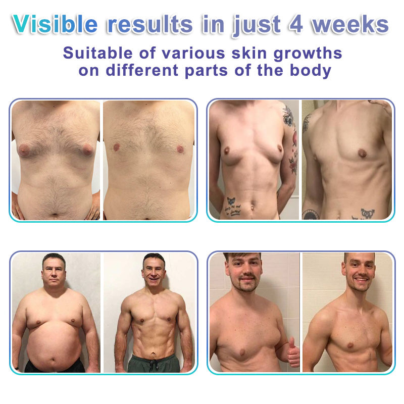 ✨GFOUK® NanoMedix Gynecomastia Chest Fatburn & Firm Patch