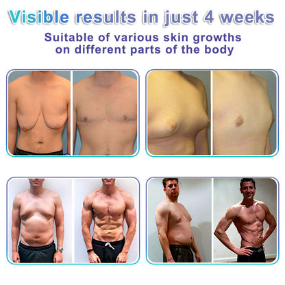 ✨GFOUK® NanoMedix Gynecomastia Chest Fatburn & Firm Patch
