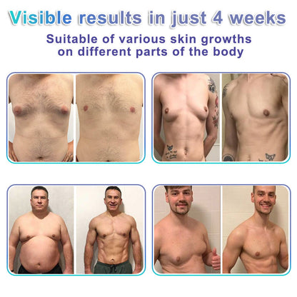 ✨GFOUK® NanoMedix Gynecomastia Chest Fatburn & Firm Patch