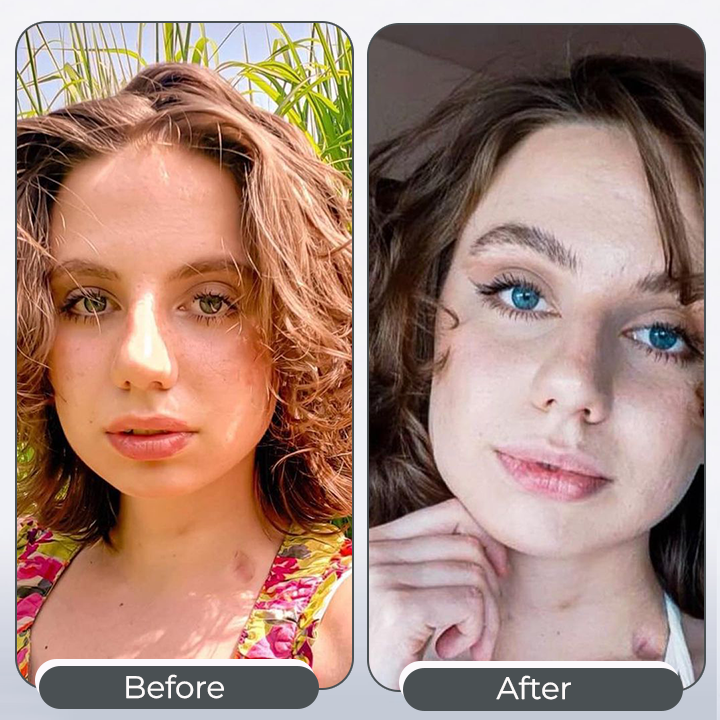 Nurbini™ 👀IrisInk Eye Drops🤩😍😏